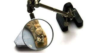 Inlays und Veneers